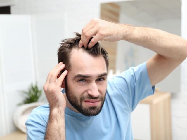 Causes of Hair Loss